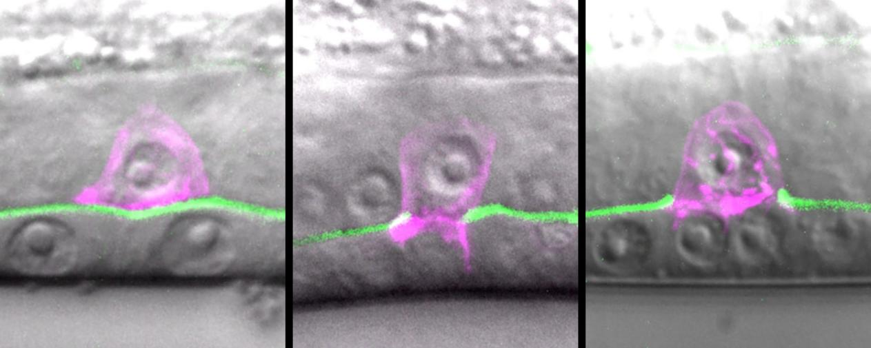 运用秀丽线虫揭示癌症转移过程中细胞侵袭行为的新机制